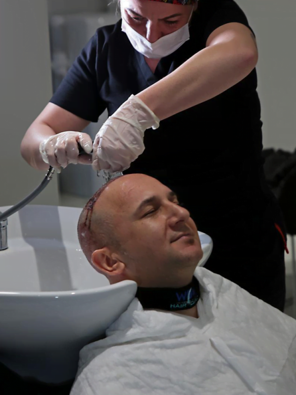 en-iyi-sac-ekim-merkezi-wowhairclinic-2