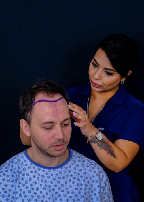 saç ekimi antalya wow hair clinic