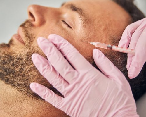 sakal-ekimi-işlemi-wow-hair-clinic